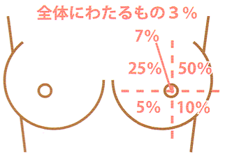 乳がん自己触診補助用具ママリーチェッカー